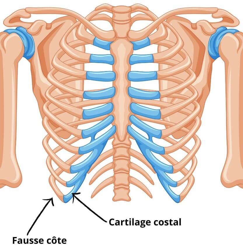 Anatomie des côtes, Syndrome de Cyriax
