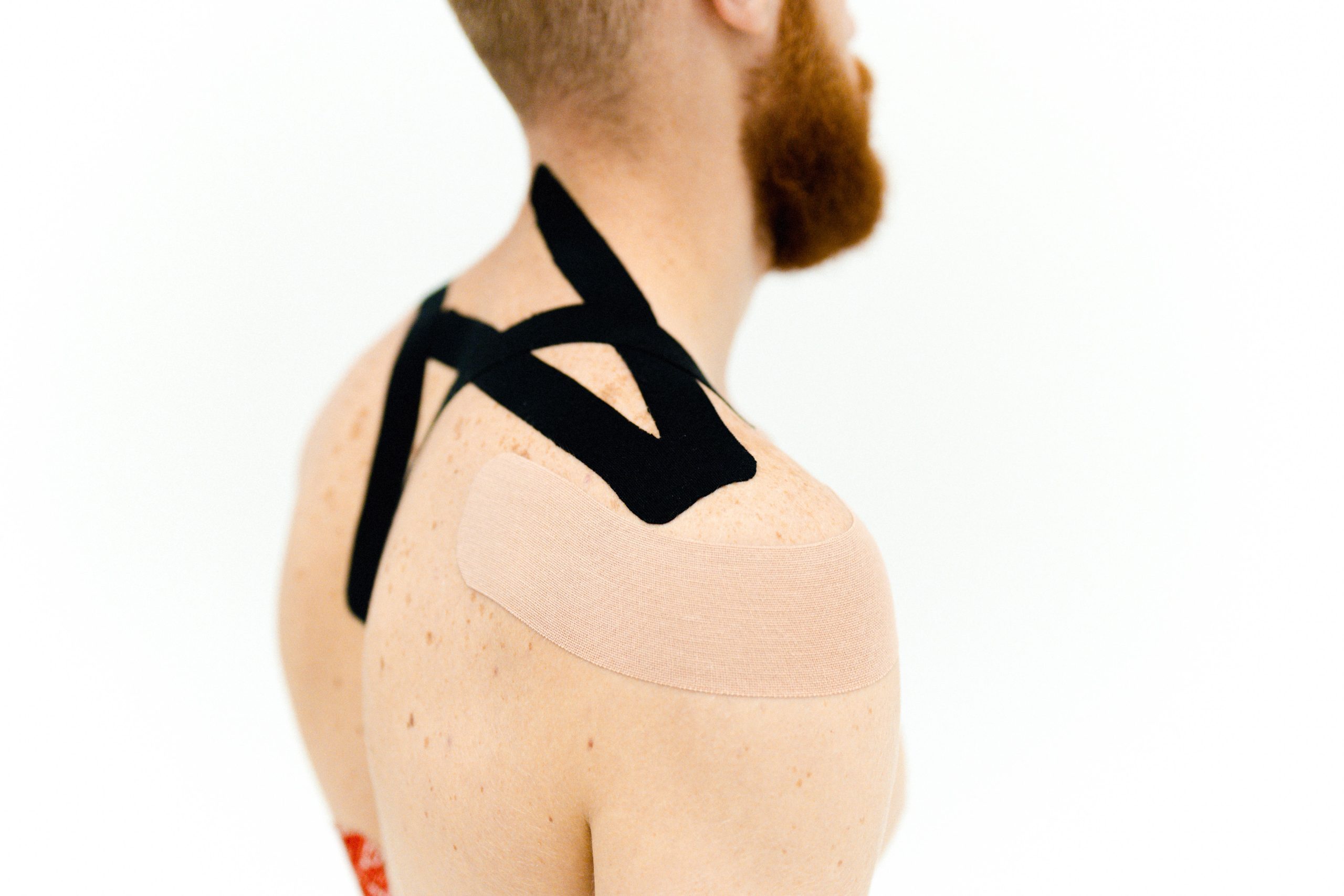 Épaule d’un patient avec des bandes de kinésiologie K-Tape, utilisées dans le cadre d’une prise en charge ostéopathique.